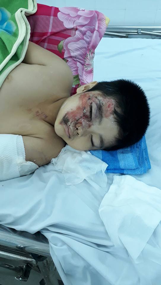 "CHÚA GIÊ XU ƠI! XIN CHO CON HẾT ĐAU"
