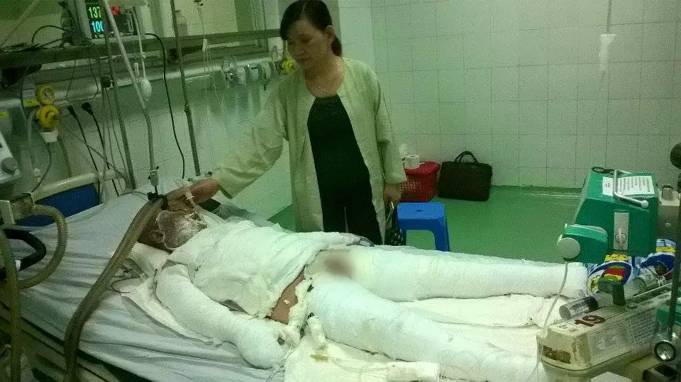 Hình ảnh cháu Phước Ân những ngày đầu mới nhập viện.