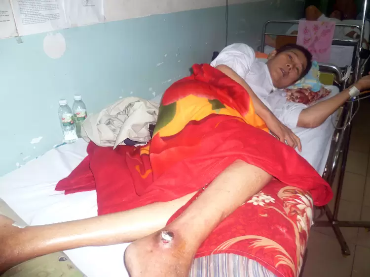 Anh Lý A Thành, Khó Khăn Và Hiểm Nghèo Nhưng Vẫn Trung Tín 1/10