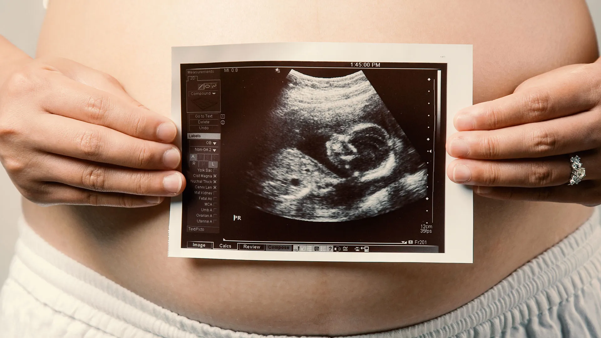 Giải Pháp Thay Thế IVF Ít Người Biết Mang Lại Hy Vọng Cho Các Cặp Vợ Chồng Hiếm Muộn